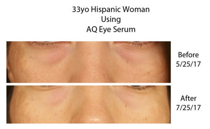 AQ Eye Serum – kasvufaktoritega noorendav silmaümbruse seerum, 15 ml