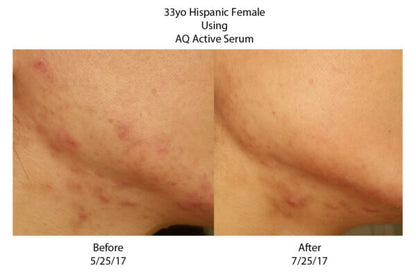 AQ Active Serum – Growth Factor Facial Serum, 30 ml