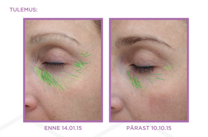 AQ Eye Serum – kasvufaktoritega noorendav silmaümbruse seerum, 15 ml