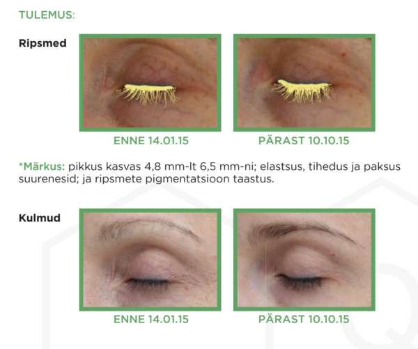 AQ Lash & Brow Ripsmeseerum, 7 ml + 30 aplikaatorit