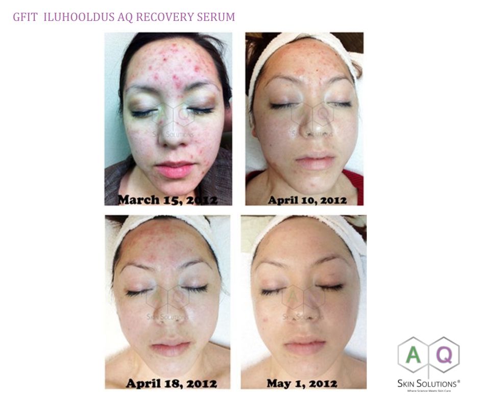 AQ Recovery Serum, 4 ml