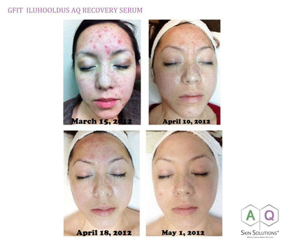 AQ Recovery Serum, 4 ml