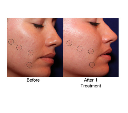 AQ Recovery Serum, 4 ml