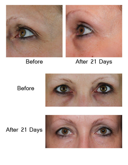 AQ Eye Serum – kasvufaktoritega noorendav silmaümbruse seerum, 15 ml