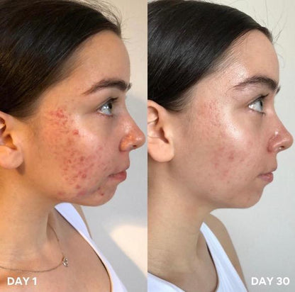 Clinisoothe+ Skin Purifier 250ML