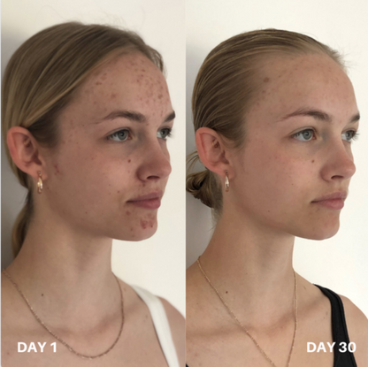 Clinisoothe+ Skin Purifier 250ML