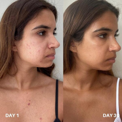 Clinisoothe+ Skin Purifier 250ML