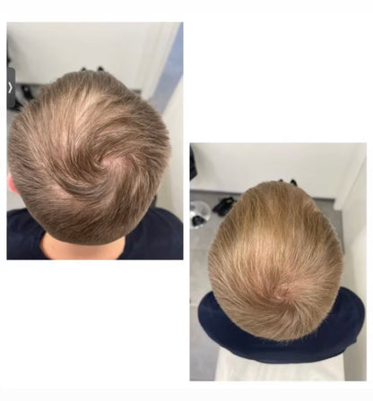 AQ Advanced Hair Complex+, 5 × 6 ml